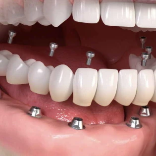 Esztétikai kezelés